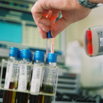 Technicien-de-Laboratoire tubes essai
